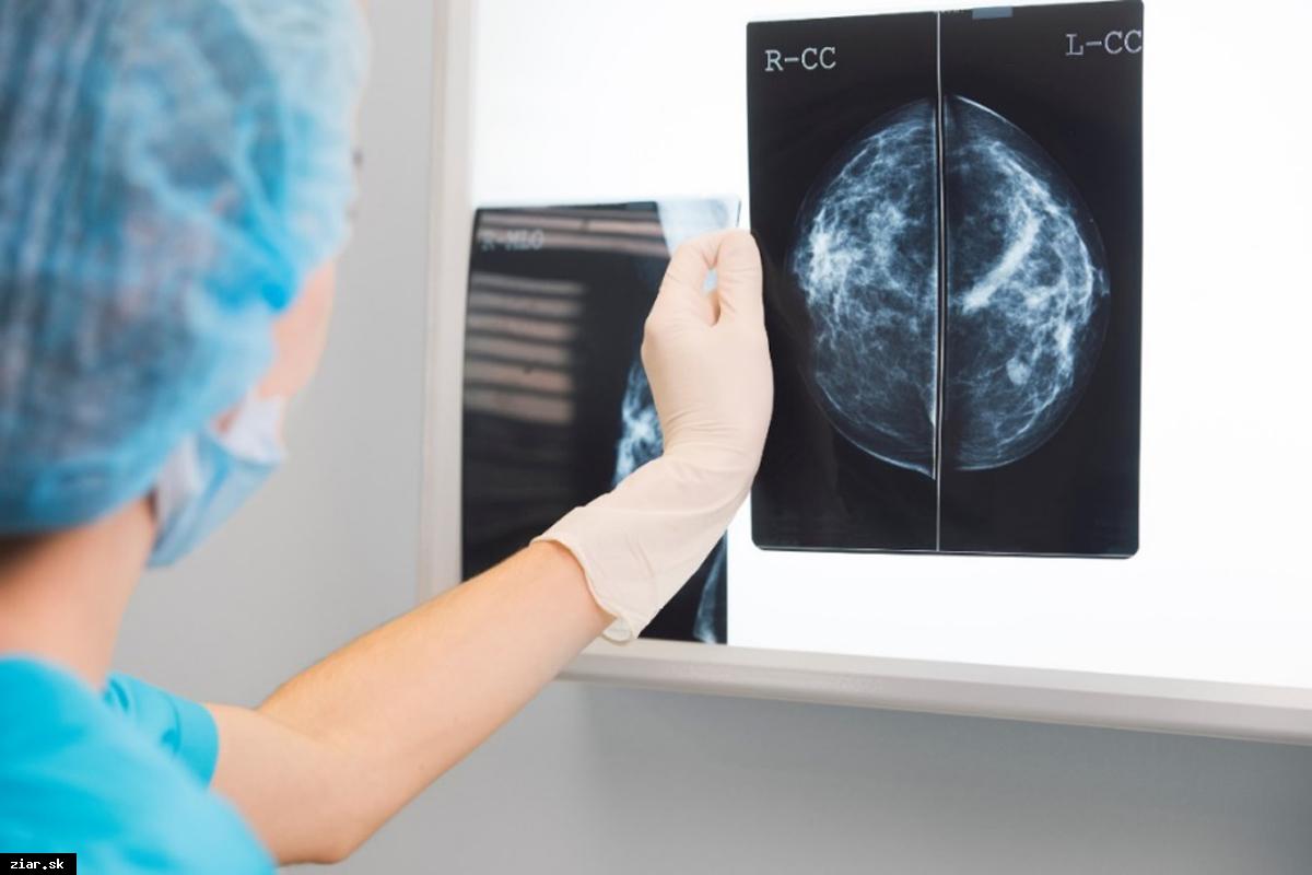Na vyšetrenie, ktorá vám môže zachrániť život, v nemocnici AGEL Žiar nad Hronom nemusíte čakať